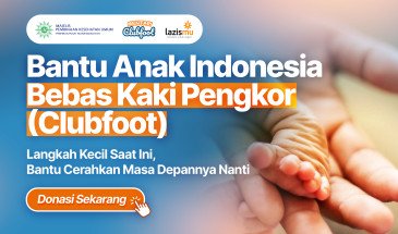 bebasclubfoot
